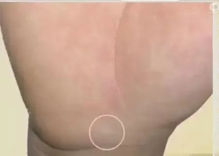 点击看大图 图片加载中...